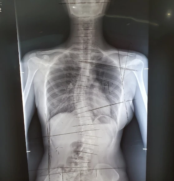 The benefits of X Ray analysis that you ought to know