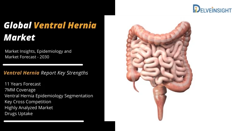 What is Ventral Hernia?