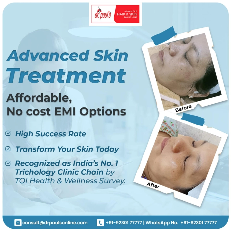 Instant Glow Facial- The Most Popular Skin Treatment In Kolkata