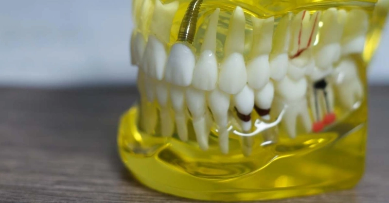 How does gum disease develop when it is untreated?