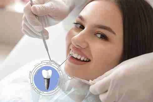 Dental Implants at Risk: The Dangers of Incorrect Prosthetics