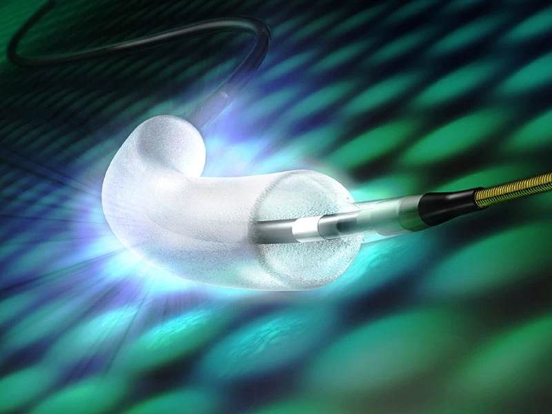 Global Drug Eluting Balloon Market Is Estimated To Witness High Growth Owing To Increasing Prevalence of Cardiovascular Diseases
