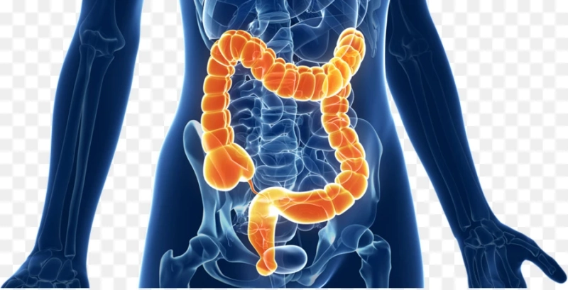 Diverticulitis Unveiled: Research Analysis and Market Trends | DLI