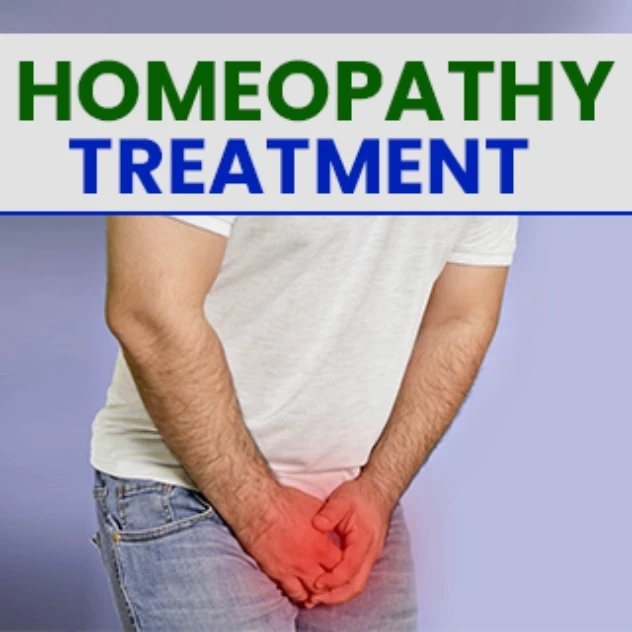 Varicocele treatment in homeopathic medicine