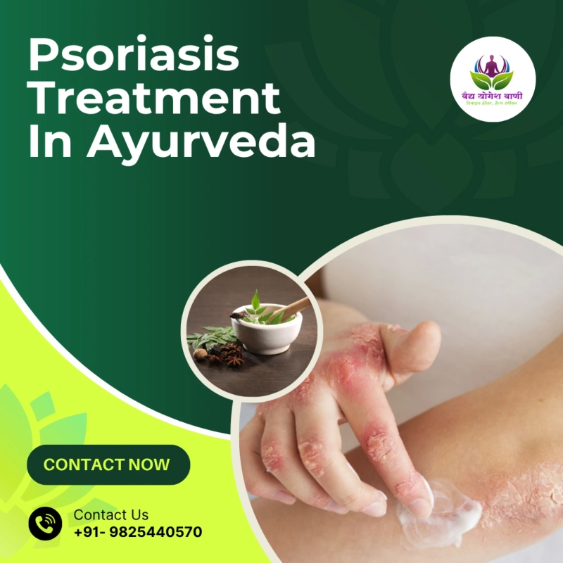 Where can I find the best Ayurvedic psoriasis treatment centers