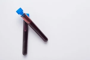 Macrophage Marker Market Trends and Forecast