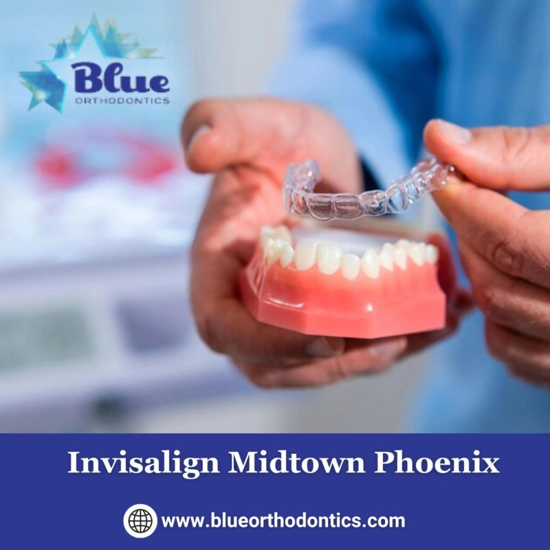 Benefits of Invisalign