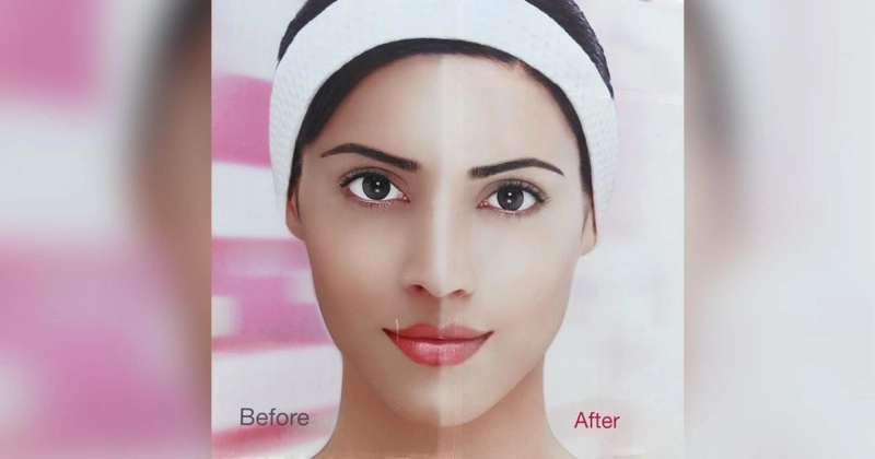 skin whitening treatments