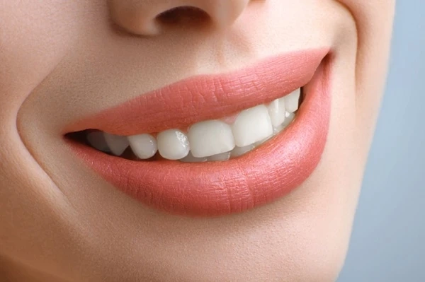 Role of Invisalign to Boost Confidence & Smile