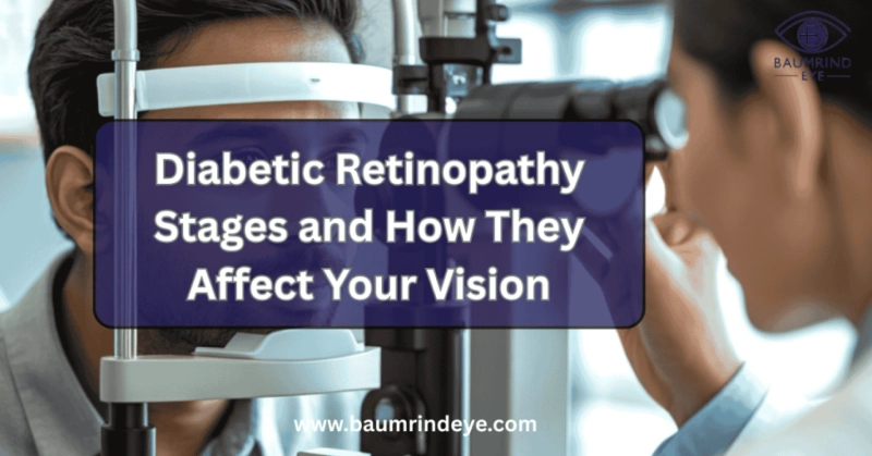 Diabetic Retinopathy Stages: How Early Detection Protects Your Vision