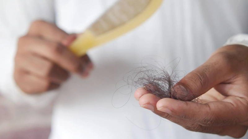 What’s the Best Hair Loss Treatment? Choosing the Right Option Based on Cause and Stage
