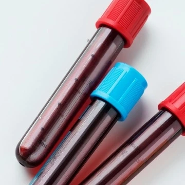 Global Blood Metabolites Market Revenue Poised for Significant Growth During the Forecast Period of