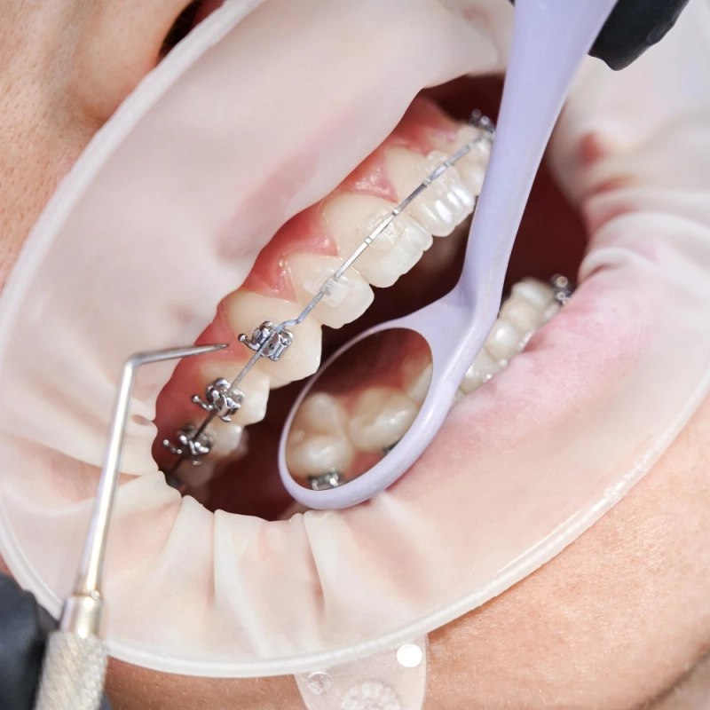 Dental Clinic in Kothrud Pune