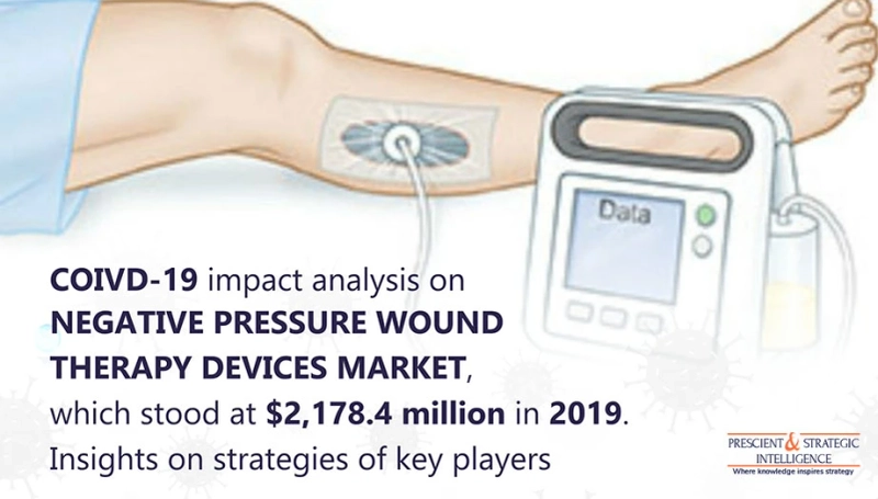 Negative Pressure Wound Therapy Predicted to Register Rapid Growth in Asia-Pacific in Future