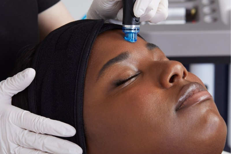 Hydrafacial: The Ultimate Refreshment For Your Skin