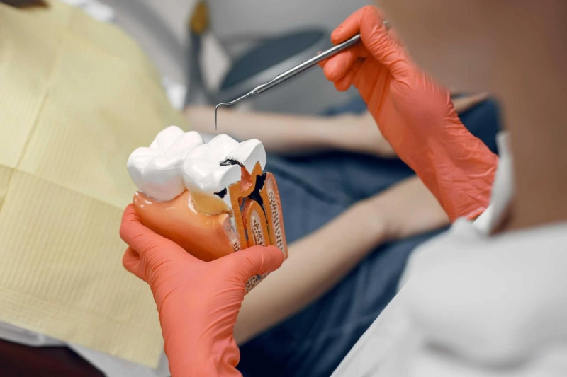 Tips for Managing Pain and Discomfort After a Root Canal Treatment