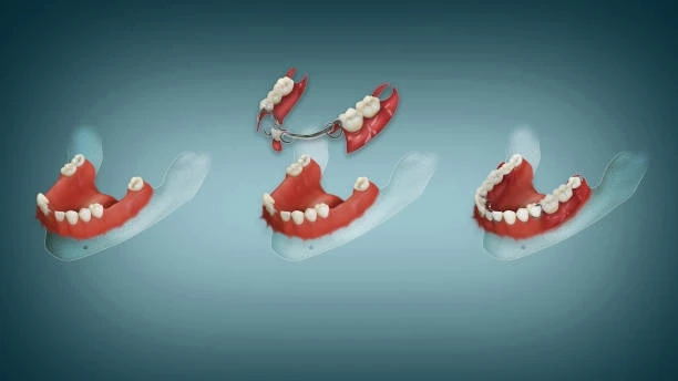 Early Signs of Gum Disease: How Periodontal Treatment Can Save Your Natural Teeth