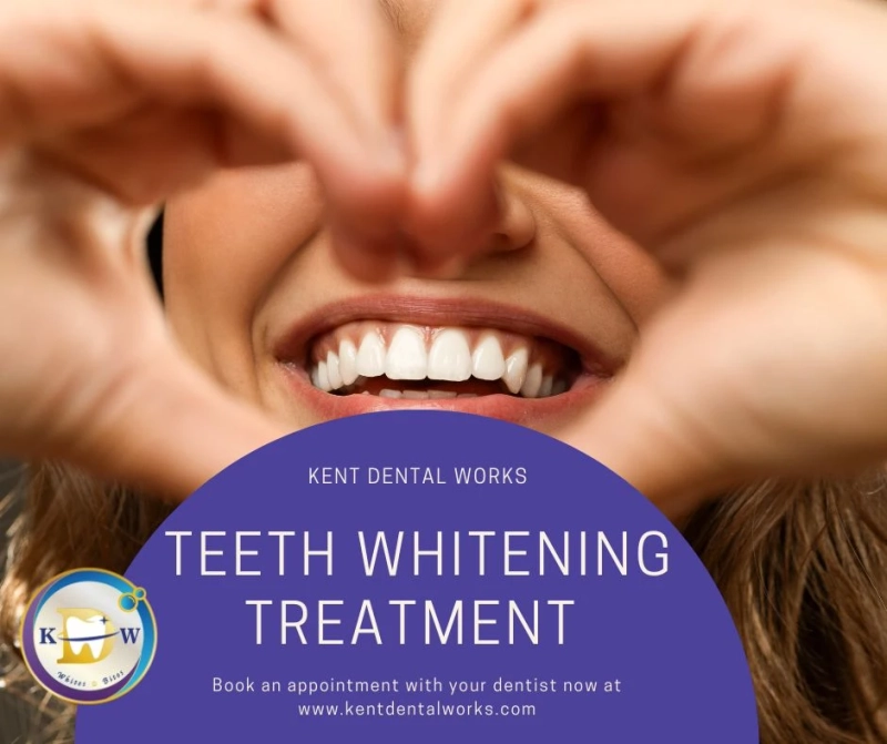 Teeth Whitening Singapore | Dental Clinic | Kent Dental Works