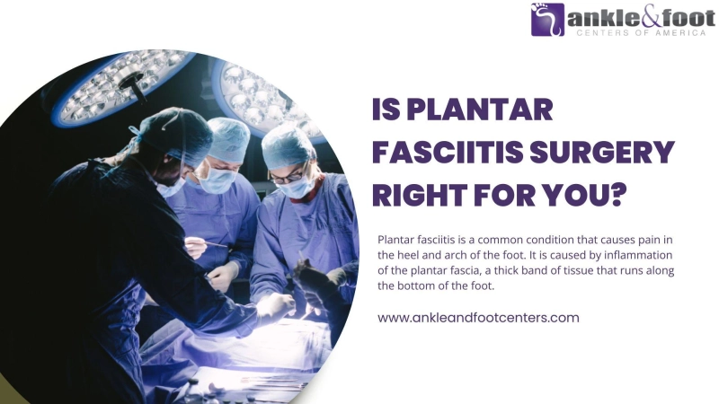 Is Plantar Fasciitis Surgery Right for You?