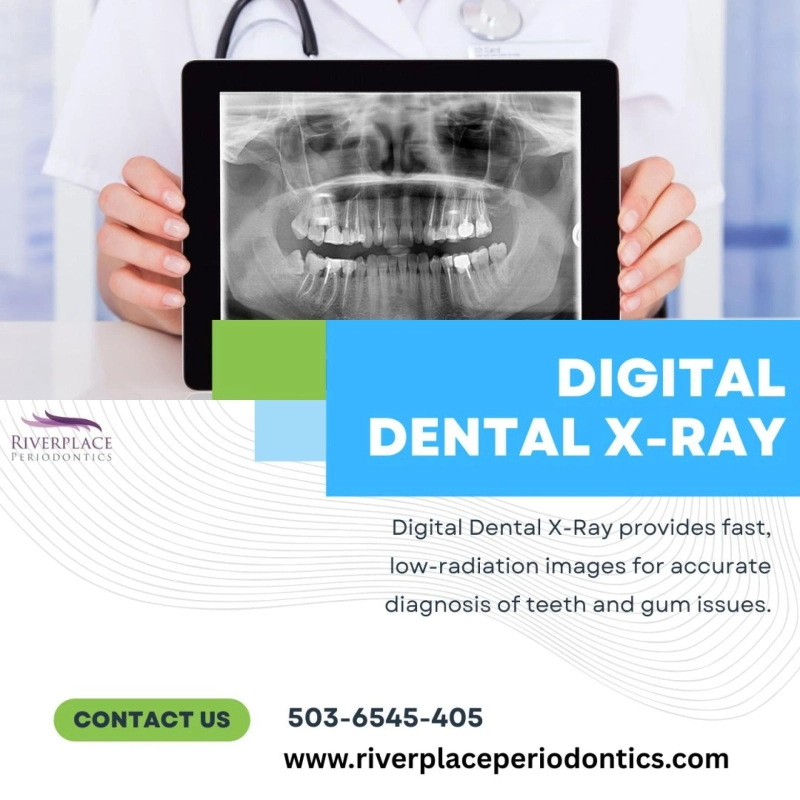 Digital X-Ray Technology and Its Impact on Dental Diagnosis