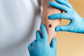 London's Healing Havens: A Guide to Top-Notch Scar Clinics