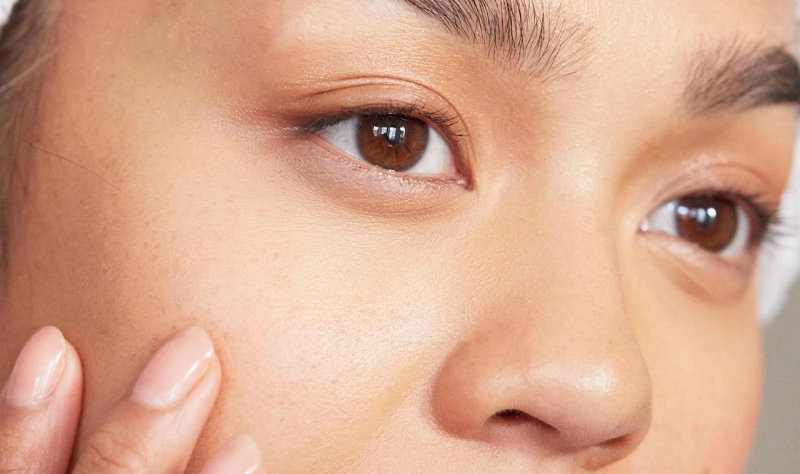 Clogged Pores: Reasons and Treatment