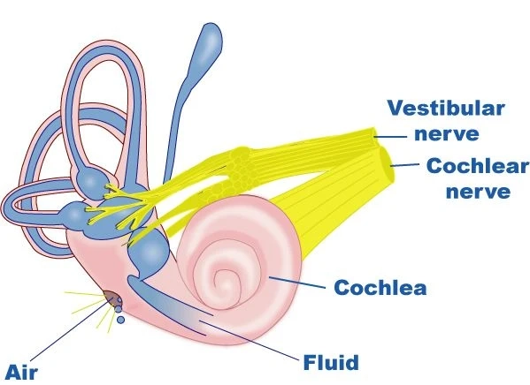  What is Perilymph fistula treatment