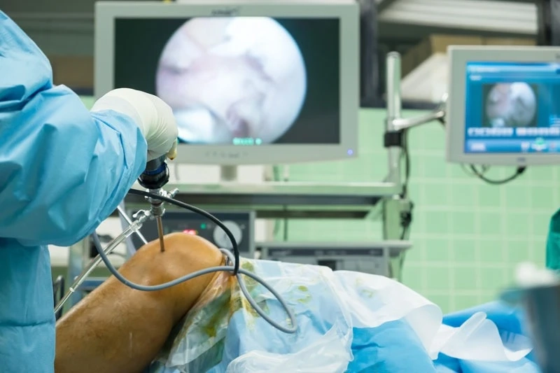Arthroscopy Surgery Delhi for Safe, Accurate, and Effective Treatment