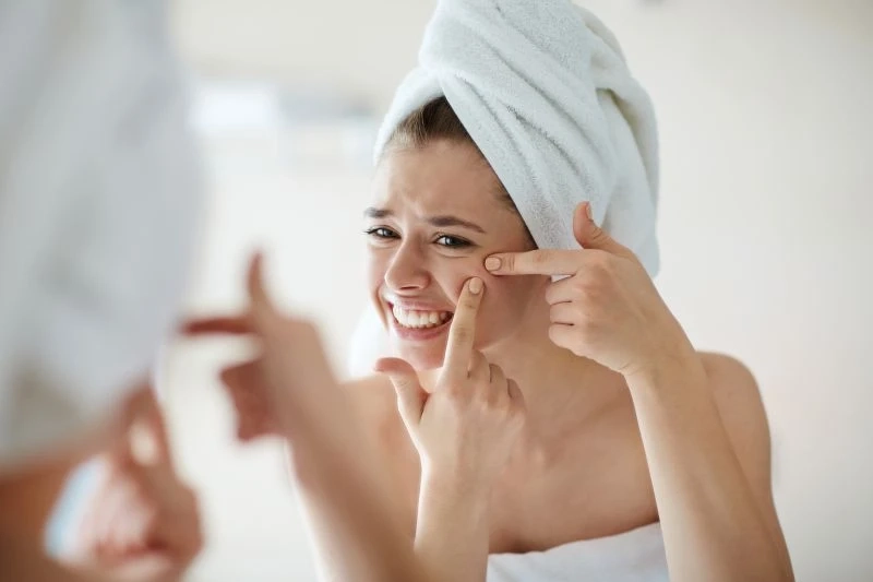 Remove Acne Scarring With Laser Treatment In Singapore