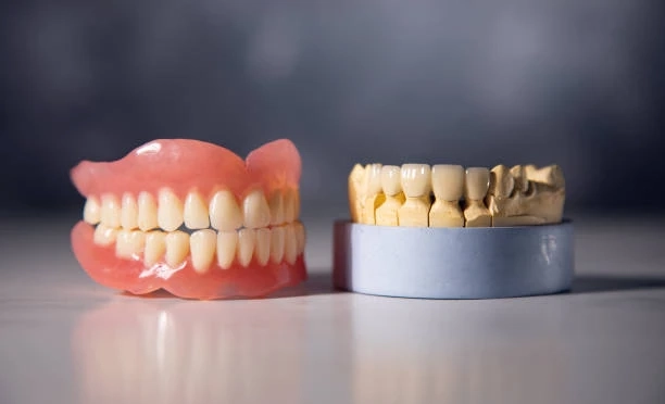 Dental Implants vs. Dentures: Which Lasts Longer?