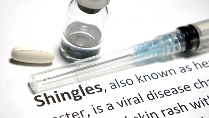 What is internal shingles?
