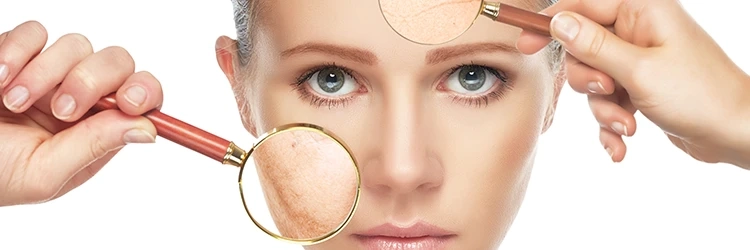How Will a Dermatologist Help Manage Acne?