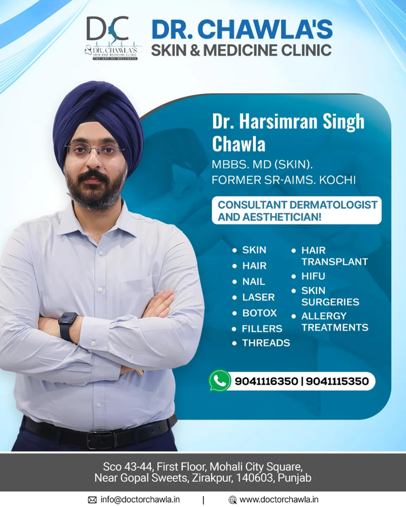 Laser Mole Removal Cost Zirakpur: Everything You Need to Know Before Treatment