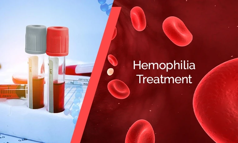 Hemophilia Treatment; alters the blood clotting factor deficiency