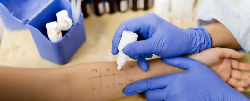 Allergy Testing Billing, Credentialing
