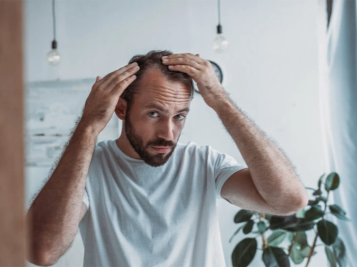 What Are The Factors To Be Considered Before Hair Transplant Procedure?