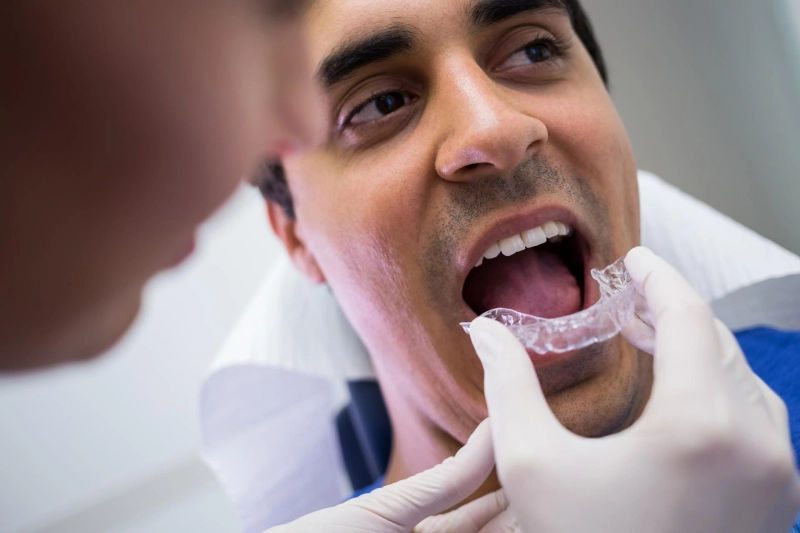 Who Is the Best Invisalign Provider in Rego Park?