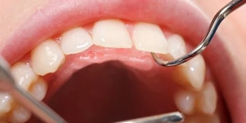 Why is Oral Surgery in Three Rivers the best oral health procedure?
