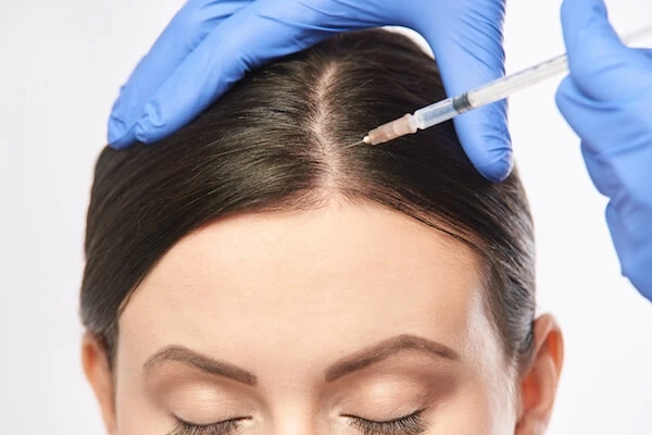 Unlocking the Potential of Hair Growth: The Marvel of Plasma Injection