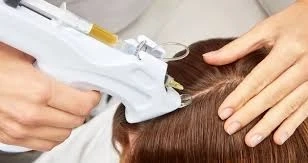 Is PRP Treatment Painful? Understanding Platelet-Rich Plasma Therapy