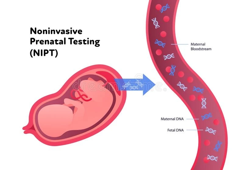 NIPT: When Can You Use It and How Accurate Is It?