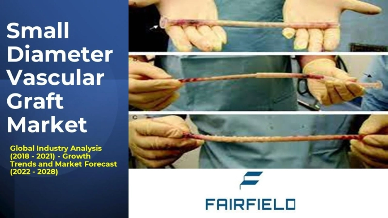 Small Diameter Vascular Graft Market Comprehensive Evaluation of the Market via inDepth Qualitative Insights by 2028