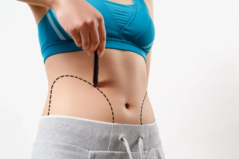 Vaser Liposuction Surgery in Dubai: Safe Effective and Long-Lasting Results