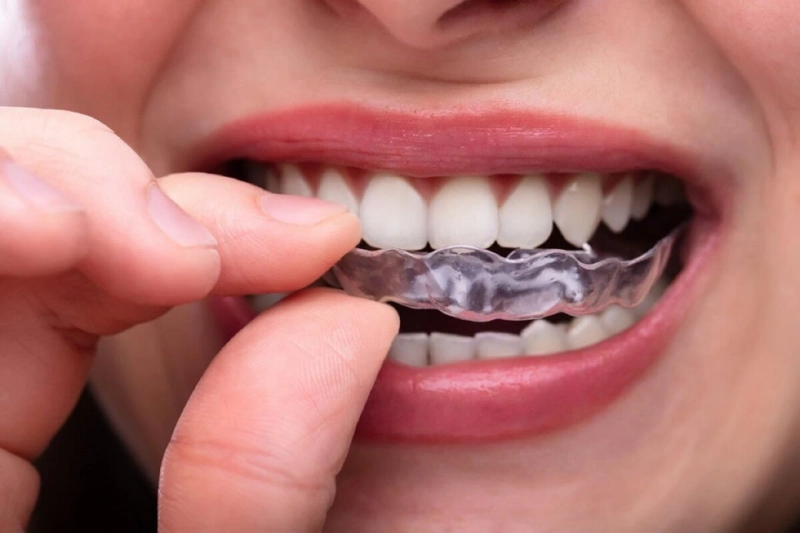 Cheap Dentist Auckland
