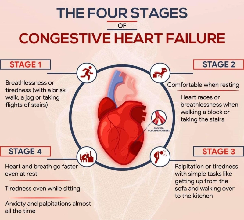 Epidemiology Studies in CHF: Gaining Insights for Better Care