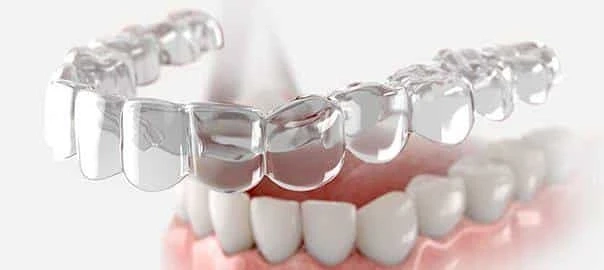 Dominant Industry Players in the Clear Aligners Market