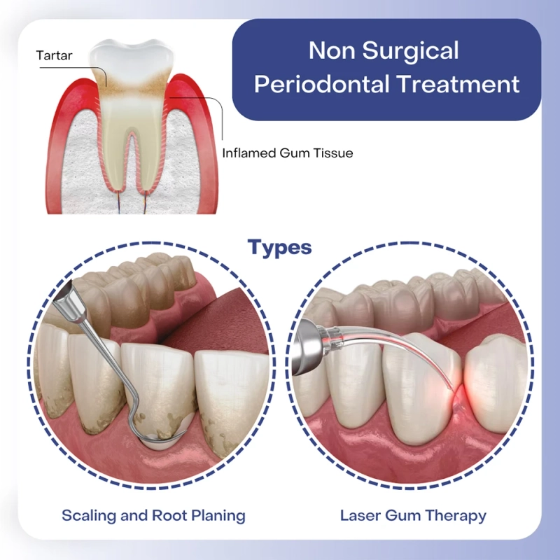 Non-Surgical Gum Treatment in Oakville: Protecting Your Smile Naturally