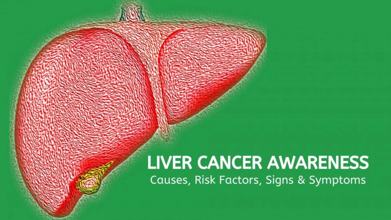 Strategic Triumph: Liver Cancer Disease Treatment and Market Entry Insights | DLI