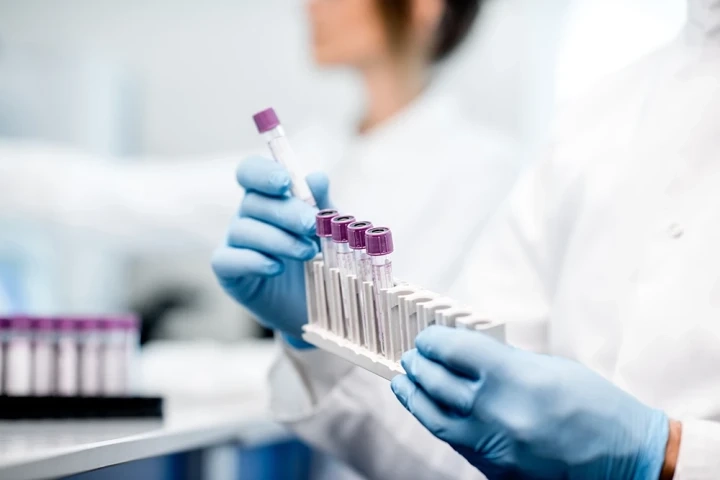 Why Choose a Blood Test Glasgow for Your Health