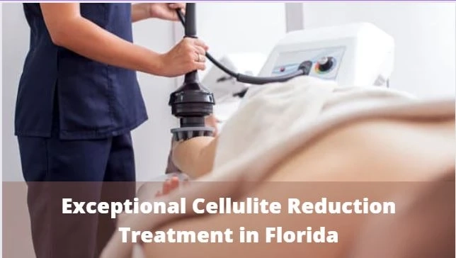 4 Reasons to Consider Cellulite Reduction Treatment